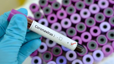 Photo of 16 muertes y 450 casos positivos notificados en últimas horas por coronavirus en RD